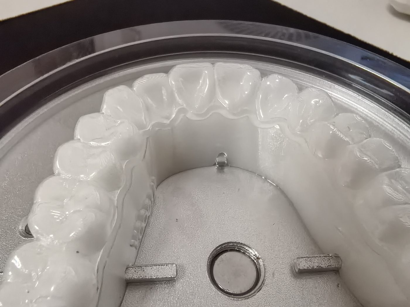 Single-arch clear aligner